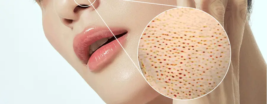 [1&1/모공삭제팩] 비알머드 릴리프 머드 마스크팩 110ml+110ml 상세페이지 18